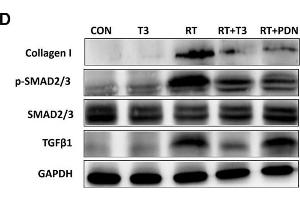 Increased DIO2 expression in lung tissue after radiation treatment and inhibition of the TGF-β1 signaling pathway by thyroid hormone. (GAPDH anticorps)