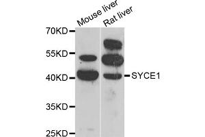 Western blot analysis of extracts of various cell lines, using SYCE1 antibody (ABIN5974347) at 1/1000 dilution. (SYCE1 anticorps)