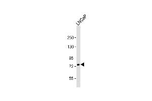 Anti-PFKL Ctr Antibody at 1:1000 dilution + LNCaP whole cell lysate Lysates/proteins at 20 μg per lane. (PFKL anticorps  (AA 371-399))