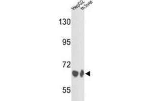 Western Blotting (WB) image for anti-Complement Factor B (CFB) antibody (ABIN3003162) (Complement Factor B anticorps)
