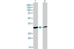 Western Blot analysis of PPIE expression in transfected 293T cell line by PPIE monoclonal antibody (M02), clone 2F5. (PPIE anticorps  (AA 2-100))