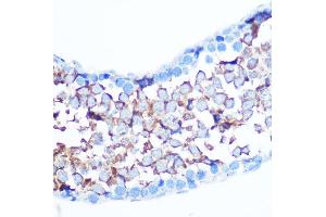 Immunohistochemistry of paraffin-embedded mouse testis using Non-phospho-Y-S127 Rabbit pAb (ABIN7271415) at dilution of 1:100 (40x lens).