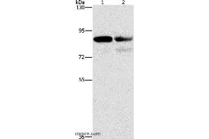 Western blot analysis of A431 and Raji cell, using CD2AP Polyclonal Antibody at dilution of 1:1000 (CD2AP anticorps)