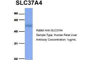 Host:  Rabbit  Target Name:  SLC37A4  Sample Type:  Human Fetal Liver  Antibody Dilution:  1.