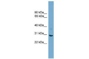 Western Blot showing SFN antibody used at a concentration of 1-2 ug/ml to detect its target protein. (14-3-3 sigma/SFN anticorps  (N-Term))