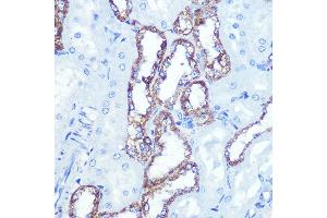 Immunohistochemistry of paraffin-embedded rat kidney using HK1 Rabbit mAb (ABIN7267638) at dilution of 1:100 (40x lens).
