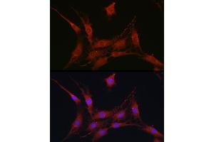 Immunofluorescence analysis of C6 cells using SLC4 / NBC Rabbit pAb (ABIN6129130, ABIN6148013, ABIN6148014 and ABIN6220962) at dilution of 1:100 (40x lens). (SLC4A4 anticorps  (AA 1-240))