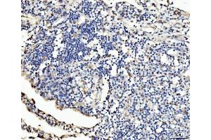 IHC analysis of PLD3 using anti-PLD3 antibody (ABIN7599439). (PLD3 anticorps  (AA 1-490))