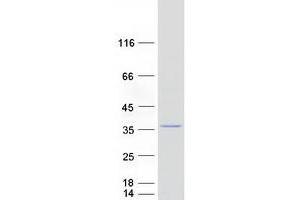 Validation with Western Blot