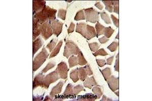 Formalin-fixed and paraffin-embedded human skeletal muscle with COG4 Antibody (C-term), which was peroxidase-conjugated to the secondary antibody, followed by DAB staining.