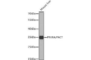 Western blot analysis of extracts of mouse liver, using PRKRA/PACT antibody (ABIN6130639, ABIN6146220, ABIN6146221 and ABIN6221069) at 1:1000 dilution. (PRKRA anticorps  (AA 1-313))
