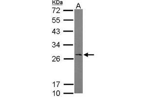 AP19035PU-N Ran BP1 antibody staining of Mouse brain (A) whole cell lysate (50 µg) at 1/1000 dilution, 12% SDS PAGE.