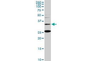 BARHL1 monoclonal antibody (M01), clone 2B11. (BARHL1 anticorps  (AA 55-154))