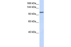 WB Suggested Anti-WDR63 Antibody Titration: 0. (WDR63 anticorps  (Middle Region))