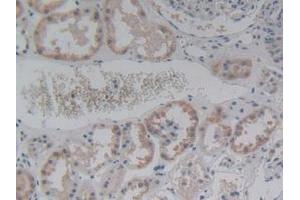 IHC-P analysis of Human Kidney Tissue, with DAB staining. (ABCC8 anticorps  (AA 679-929))