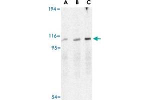 Western blot analysis of ERN1 in A-20 cell lysate with ERN1 polyclonal antibody  at (A) 0. (ERN1 anticorps  (C-Term))