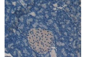 Detection of OCM in Mouse Pancreas Tissue using Polyclonal Antibody to Oncomodulin (OCM)