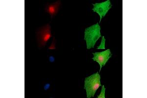 ABIN7097004 and ABIN7101071 staining  cells by IF/ICC. (ARIP4 anticorps)