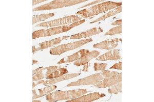 Immunohistochemical analysis of paraffin-embedded human skeletal muscle tissue using (ABIN656548 and ABIN2845810) performed on the Leica® BOND RXm.
