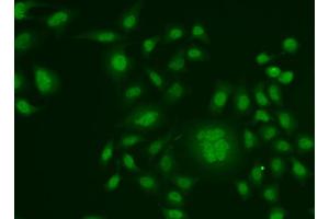 Immunofluorescence analysis of HeLa cells using ERCC1 antibody (ABIN5973037). (ERCC1 anticorps)