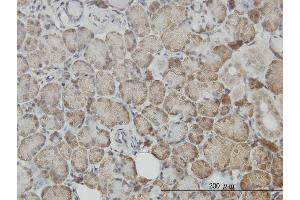 Immunoperoxidase of monoclonal antibody to TP53 on formalin-fixed paraffin-embedded human salivary gland.