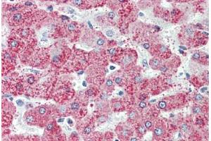 Liver, Human: Formalin-Fixed, Paraffin-Embedded (FFPE)