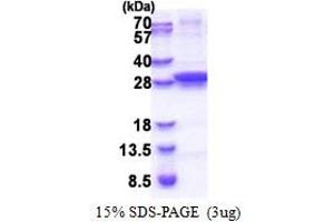 SDS-PAGE (SDS) image for Uracil-DNA Glycosylase (UNG) (AA 1-229) protein (His tag) (ABIN5853288)