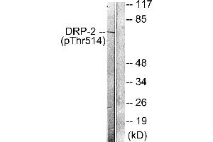 Immunohistochemistry analysis of paraffin-embedded human brain tissue using DRP-2 (Phospho-Thr514) antibody. (DRP2 anticorps  (pThr514))