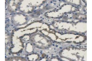 IHC-P analysis of Human Kidney Tissue, with DAB staining. (SOD3 anticorps  (AA 19-240))