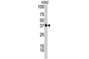Image no. 1 for anti-Complement Factor H-Related 1 (CFHR1) (C-Term) antibody (ABIN452839) (CFHR1 anticorps  (C-Term))