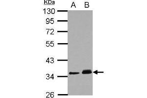 WB Image Sample (30 ug of whole cell lysate) A: A431 B: HeLa 10% SDS PAGE antibody diluted at 1:1000 (PPM1J anticorps)