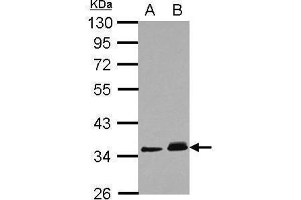 PPM1J anticorps