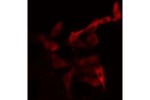 ABIN6266992 staining 293 cells by IF/ICC.