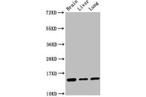 Western Blot Positive WB detected in: Mouse brain tissue, Rat liver tissue, Rat lung tissue All lanes: Histone H2B type 1-K antibody at 0.