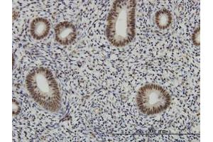 Image no. 2 for anti-AF4/FMR2 Family, Member 4 (AFF4) (AA 1-109) antibody (ABIN466197) (AFF4 anticorps  (AA 1-109))