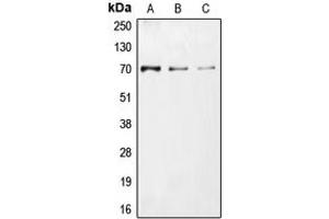 Western blot analysis of CDC25A (pS75) expression in HEK293T UV-treated (A), Jurkat UV-treated (B), NIH3T3 (C) whole cell lysates. (CDC25A anticorps  (pSer75))