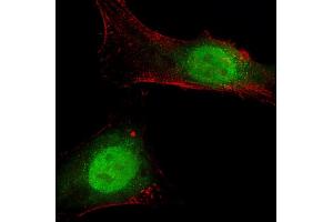 Immunofluorescent analysis of 4 % paraformaldehyde-fixed, 0.