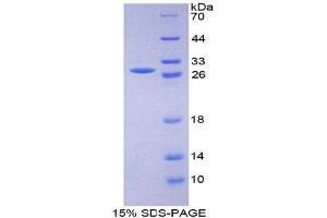 SDS-PAGE (SDS) image for CD33 (CD33) (AA 18-240) protein (His tag,T7 tag) (ABIN2126746)