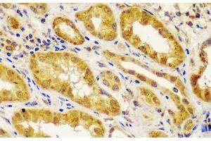 Immunohistochemistry of paraffin-embedded Human kidney using MT1-MMP Polyclonal Antibody at dilution of 1:100 (40x lens). (MMP14 anticorps)