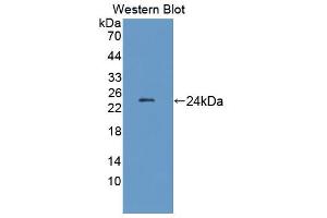 Western blot analysis of the recombinant protein. (LAMB2 anticorps  (AA 939-1129))