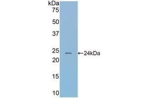 Detection of Recombinant CBG, Mouse using Polyclonal Antibody to Corticosteroid Binding Globulin (CBG)