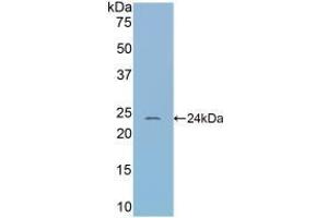 Detection of Recombinant CBG, Mouse using Polyclonal Antibody to Corticosteroid Binding Globulin (CBG) (SERPINA6 anticorps  (AA 57-256))