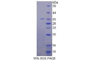 SDS-PAGE (SDS) image for 4-Aminobutyrate Aminotransferase (ABAT) (AA 236-500) protein (His tag) (ABIN6239351)