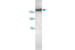 Western blot analysis of HeLa cell lysate with RICTOR polyclonal antibody  at 1 : 500 dilution. (RICTOR anticorps  (AA 1406-1700))