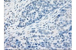 Immunohistochemical staining of paraffin-embedded Kidney tissue using anti-PPP5Cmouse monoclonal antibody. (PP5 anticorps)