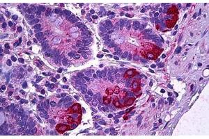 Human Intestine, Paneth Cells: Formalin-Fixed, Paraffin-Embedded (FFPE) (IL12A anticorps)