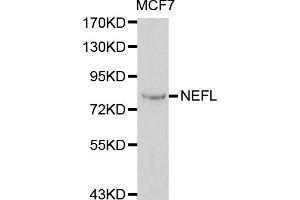 Western blot analysis of extracts of MCF-7 cells, using NEFL antibody. (NEFL anticorps)