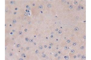 Detection of TXNIP in Mouse Brain Tissue using Polyclonal Antibody to Thioredoxin-interacting Protein (TXNIP)