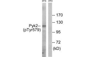 Western Blotting (WB) image for anti-PTK2B Protein tyrosine Kinase 2 beta (PTK2B) (pTyr579) antibody (ABIN1847712)