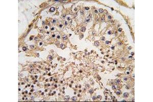 IHC analysis of FFPE human testis tissue stained with Bcl-2 antibody
